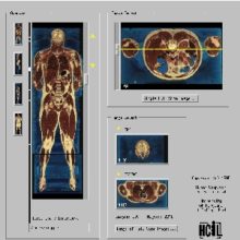 Проект видимый человек
