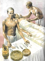 Хирургия Древней Индии