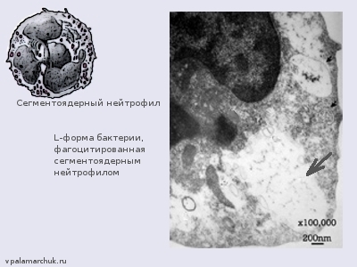 L-форма бактерии внутри нейтрофила