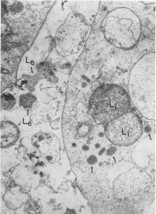 L-форма бктерии внутри клетки