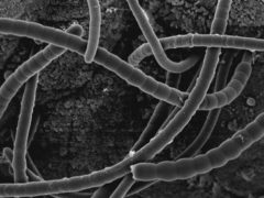 Сегментированные нитчатые (филаментные) бактерии: как формируется иммунитет кишечника