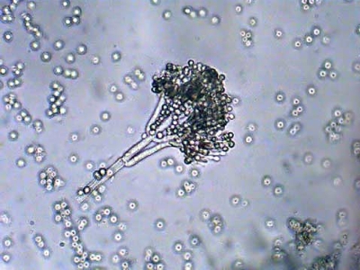 пенициллин под микроскопом
