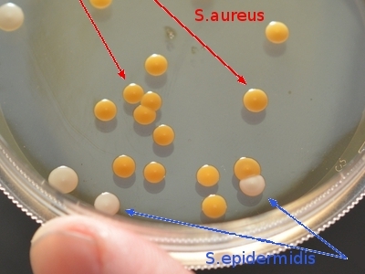 эпидермальный и золотистый стафилококк колонии