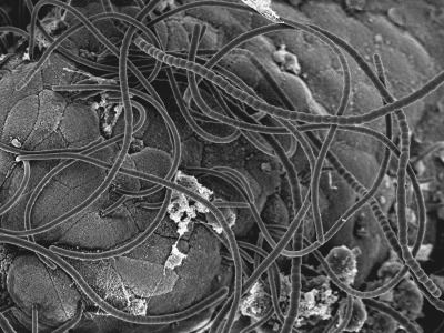 сегментированные нитевидные бактерии в микроскопе