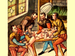 История лечения паховых грыж